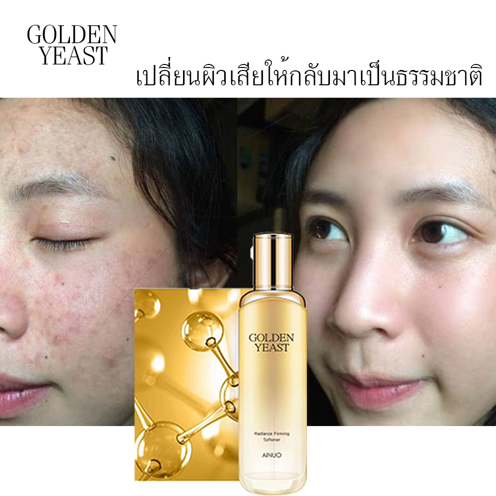 หน้าใส หน้านุ่ม ต้องลองครับ ขนาด 120 ml Golden Yeast เพิ่มความกระจ่างใส และปรับผิวให้เนียนนุ่ม เป็นธรรมชาติ Moisturing Toner and Radiance Firming Softener จะใช้ก่อนแต่งหน้า หรือก่อนนอนก็ได้
