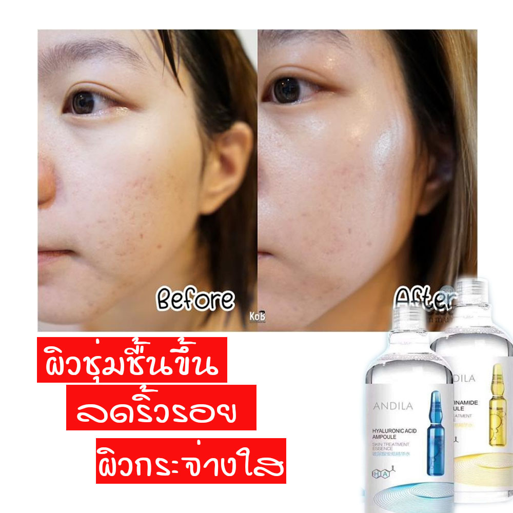 มาส์กหน้า น้ำตบ บำรุงผิว ให้สดชื้น ลดริ้วรอย กระชับรูขุมขน  เห็นผลใน 1 ขวดแรก
