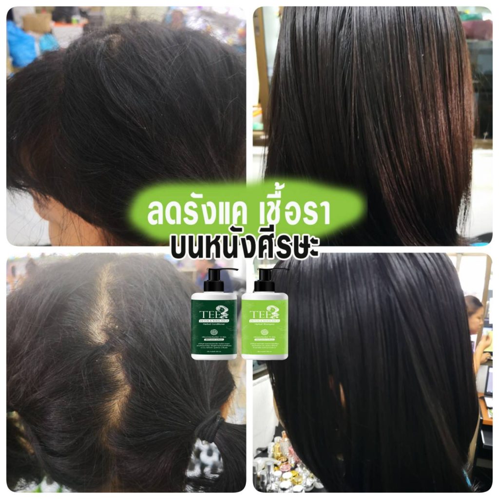แชมพูและครีมนวดผมสมุนไพร by tee ลดผมร่วง ขจัดรังแค ชะลอการเกิดผมหงอก บำรุงหนังศีรษะ ยับยั้งเชื้อราบนหนังศีรษะ