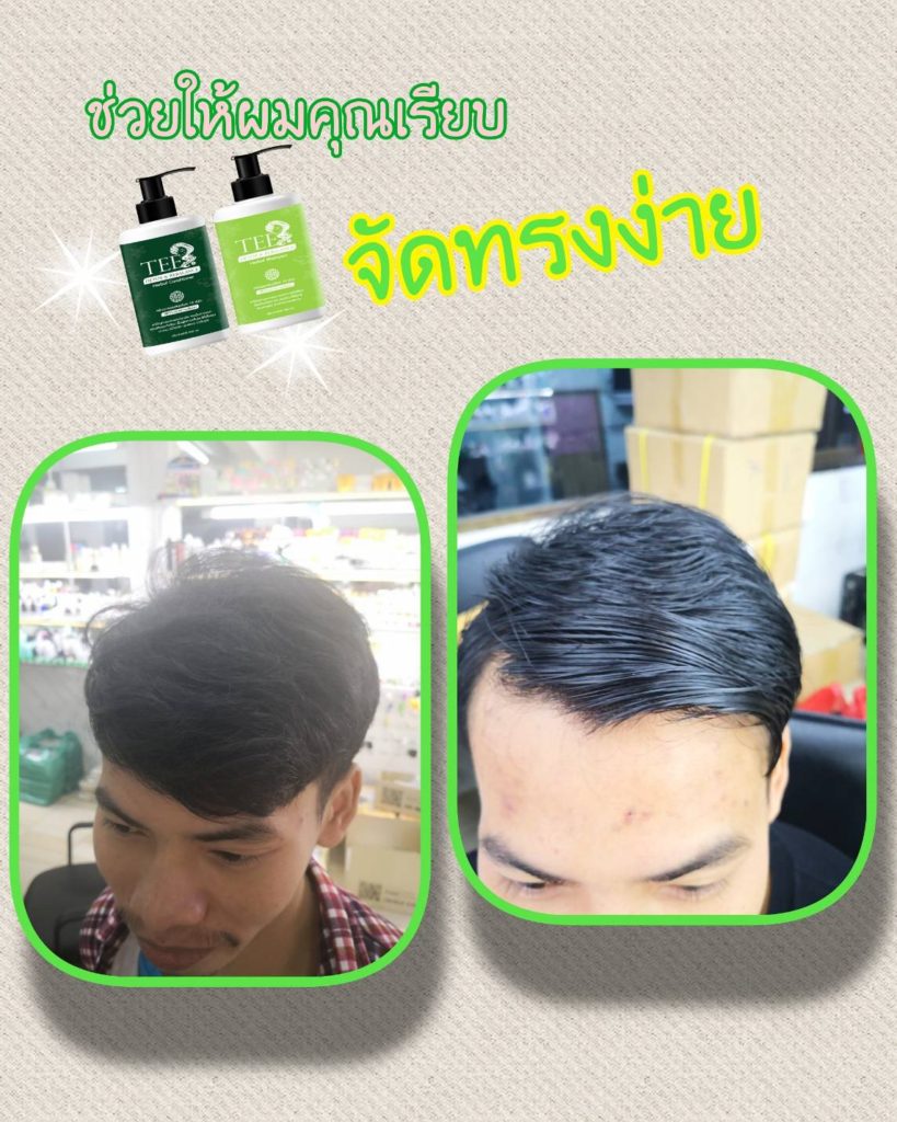 แชมพูและครีมนวดผมสมุนไพร by tee ลดผมร่วง ขจัดรังแค ชะลอการเกิดผมหงอก บำรุงหนังศีรษะ ยับยั้งเชื้อราบนหนังศีรษะ